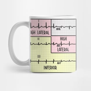 Hand Drawn Electrocardiogram (ECG) Pastel Mug